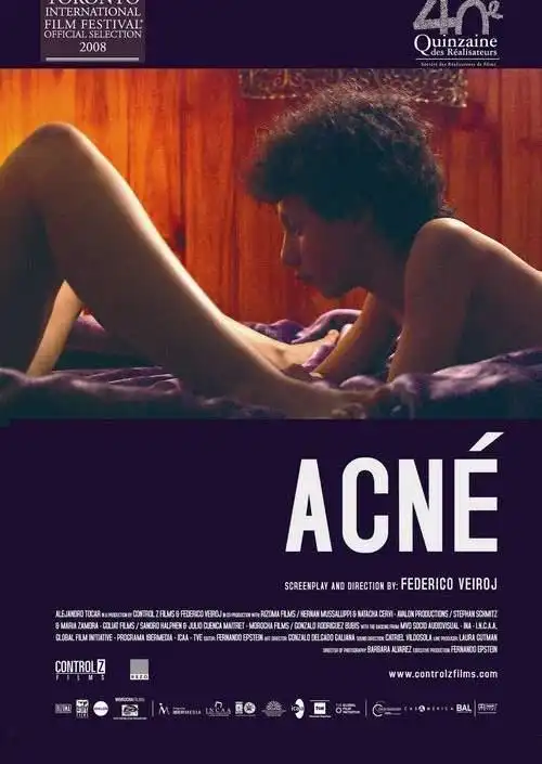 Watch and Download Acne 4