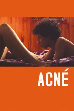 Watch and Download Acne