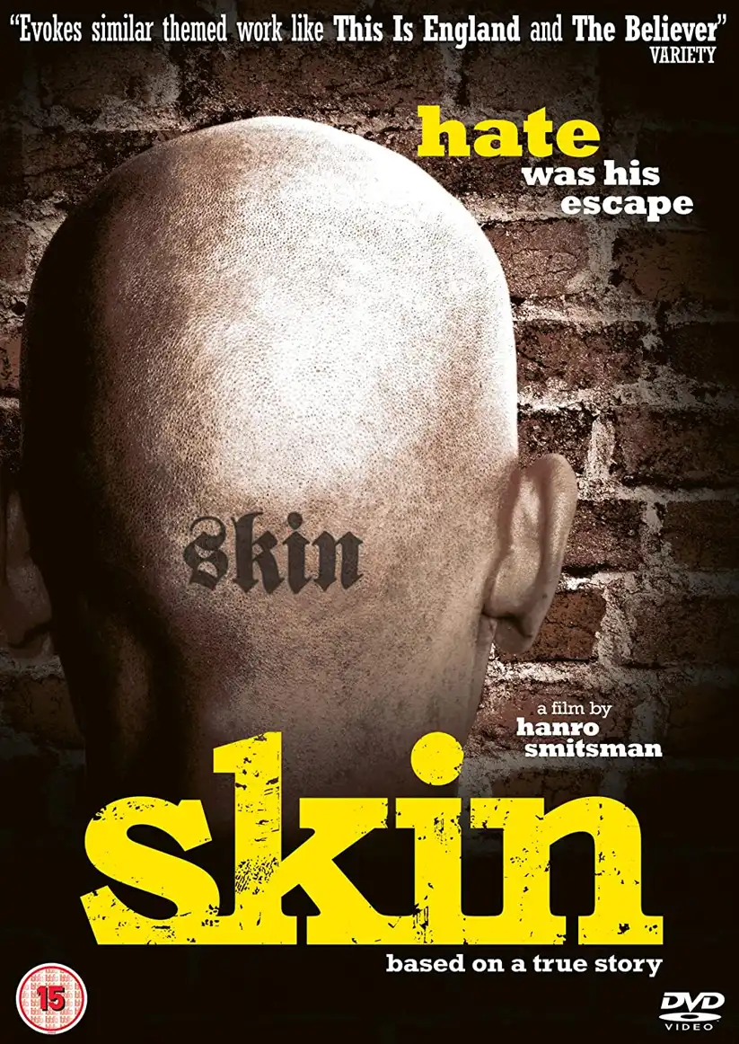 Watch and Download Skin 10