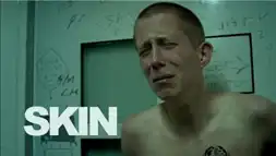 Watch and Download Skin 8