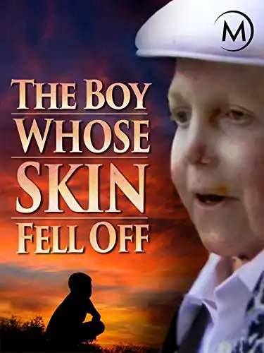 Watch and Download The Boy Whose Skin Fell Off 2