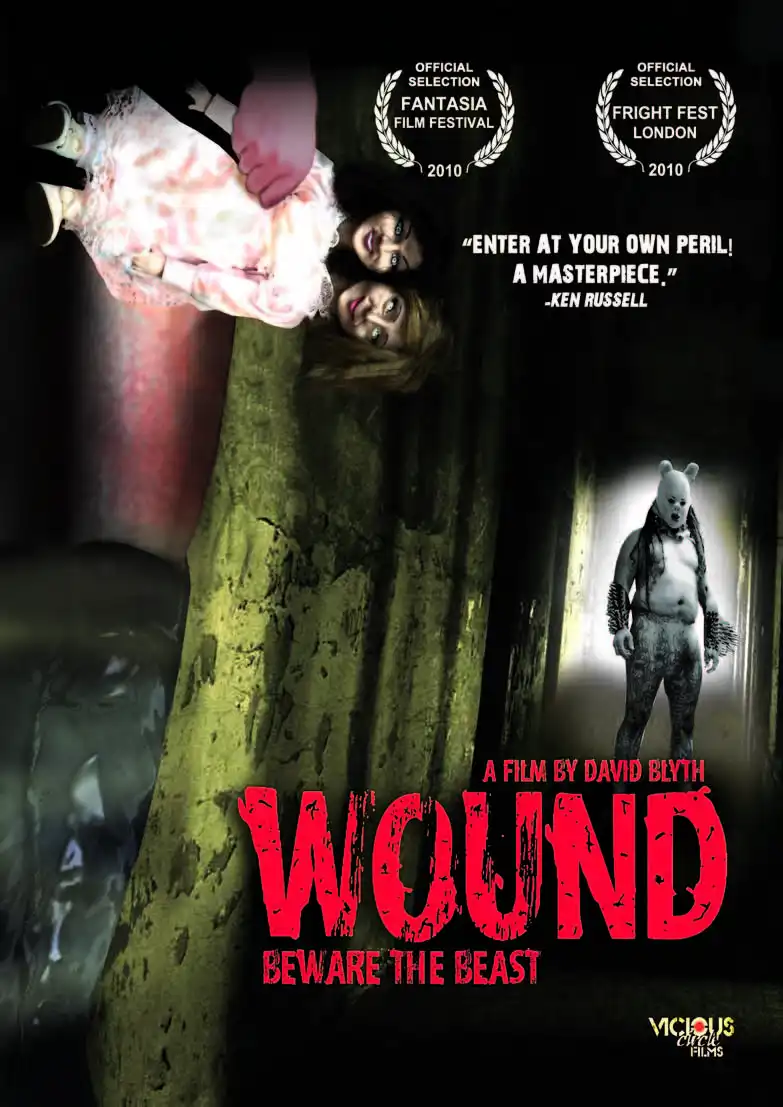 Watch and Download Wound 1